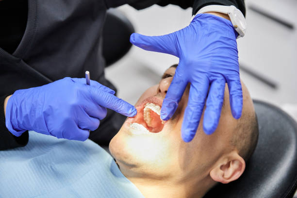 Best Emergency Dental Extractions in Pittston, PA